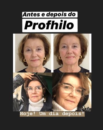 Ofereça um presente a si própria antes que chegue o Verão