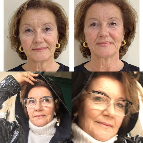 Ofereça um presente a si própria antes que chegue o Verão